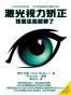 激光视力矫正：知道这些就够了